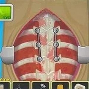 Operate Now: Scoliosis Surgery Game Medical Simulation
